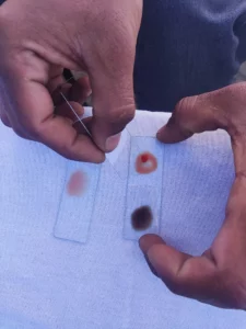 blood test pithoragarh